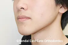 治療後