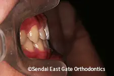 治療後