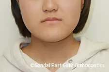 治療前