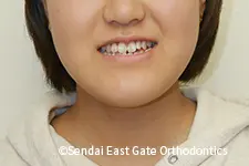 治療前