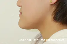 治療前
