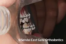 治療中