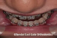 治療中