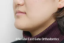 治療後