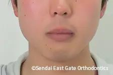治療前