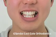 治療前