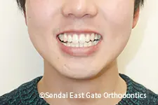 治療後