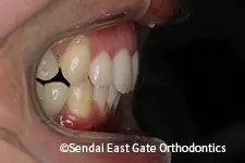 治療後