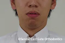 治療前