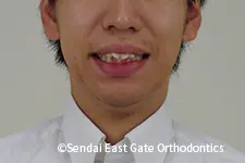 治療前