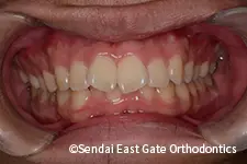 治療前