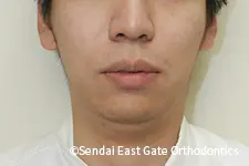 治療後
