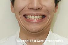 治療後