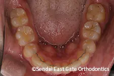 治療後