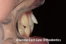 治療前