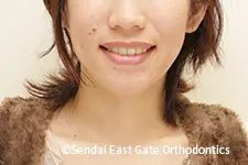 治療後