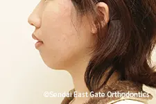 治療後