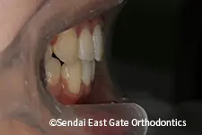 治療後