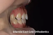 治療前