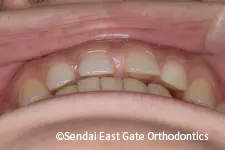 治療前