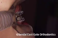 治療中