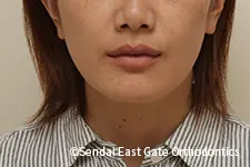 治療後