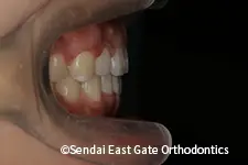 治療後