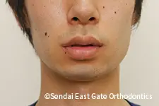 治療前