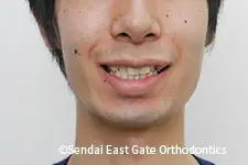 治療前
