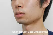 治療前