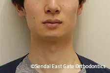 治療後