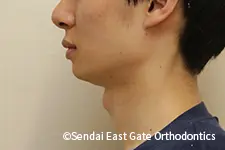 治療後