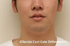 治療後