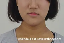 治療前