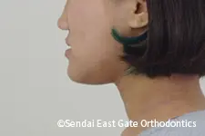 治療前