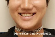 治療後