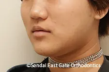 治療後