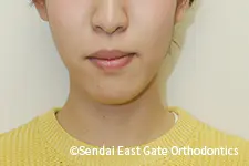 治療前