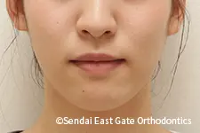 治療後