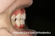 治療後