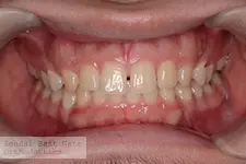 治療前