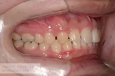 治療前
