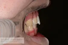 治療前