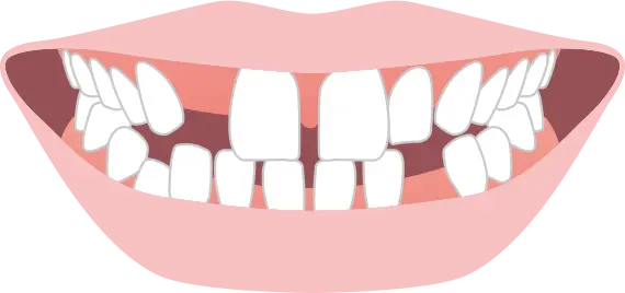 先天欠損