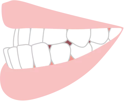 下の歯が出ている