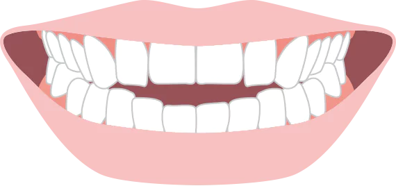 前歯が噛み合わない